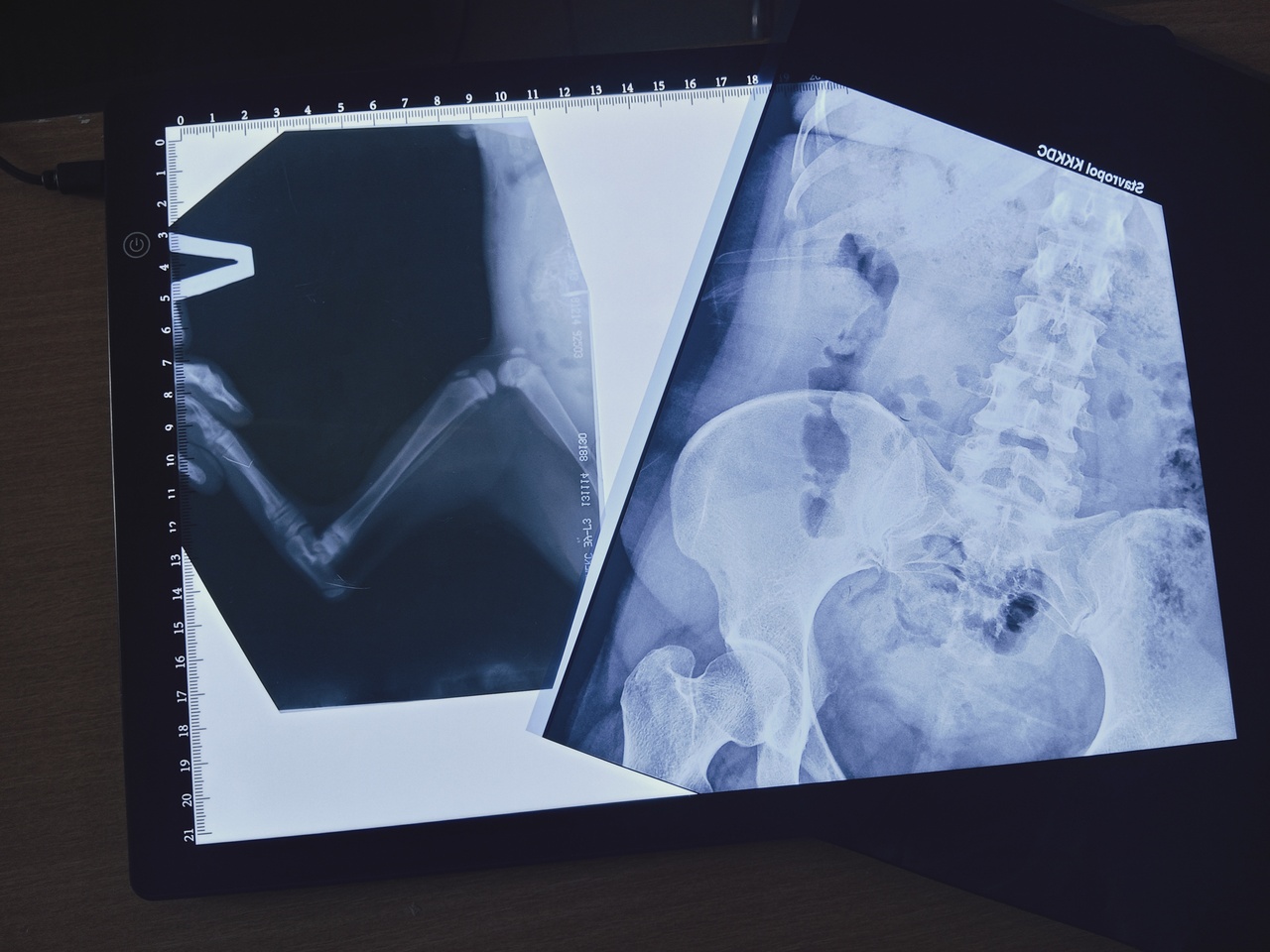 Интерактивная лекция «Всевидящие лучи»